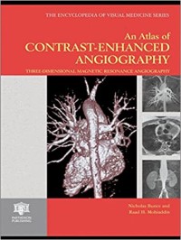 Image of An Atlas of Contrast-Enhanced Angiography: Three Dimensional Magnetic Resonance Angiography