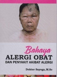Image of Bahaya Alergi Obat dan Penyakit Akibat Alergi