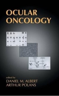 Image of Ocular Oncology