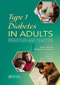 Image of Type 1 Diabetes in Adults Principles and Practice